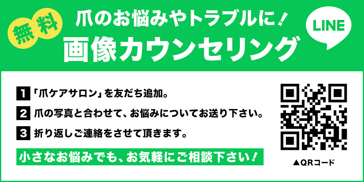 爪のお悩みやトラブルに！無料画像カウンセリング